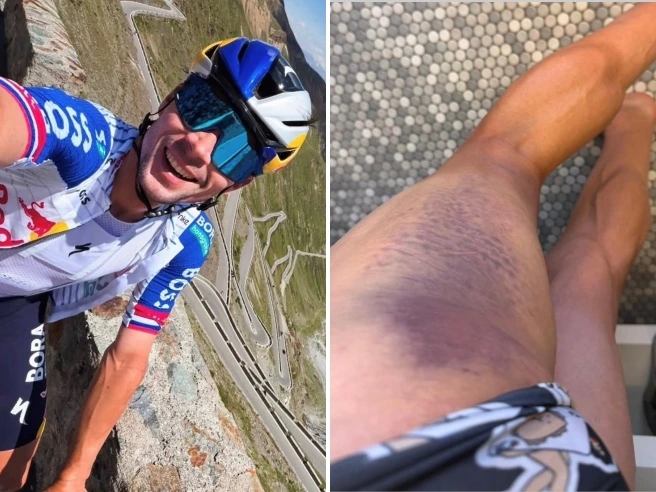Nuovo stop per Roglic: travolto da un'auto in allenamento, salta San Sebastian e Burgos: «È la vita»